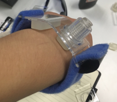 【醫(yī)療應(yīng)用】動脈止血壓塊手環(huán)固化